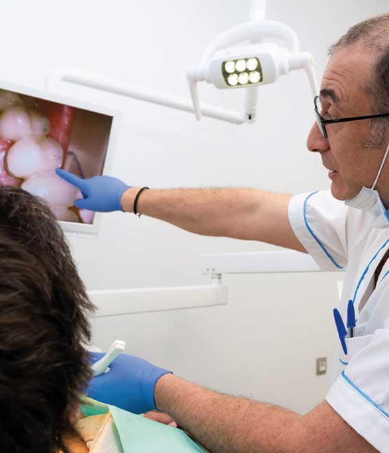 Implantes dentales de calidad en madrid